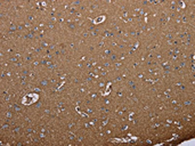 AQP4 Antibody