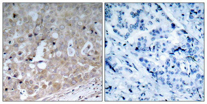 KDR (Ab-1175) Antibody