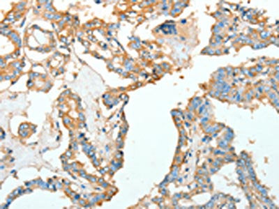 ACTN1 Antibody
