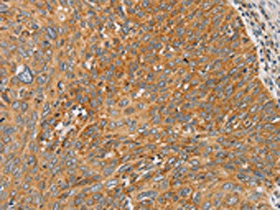 ARSK Antibody
