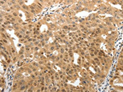 MAP1A Antibody