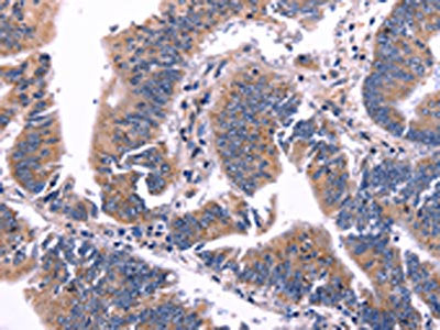 ARC Antibody