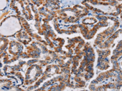 PLCB3 Antibody