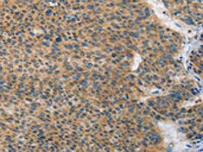 ANAPC13 Antibody