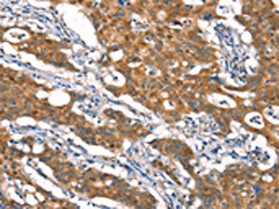 CYLD Antibody