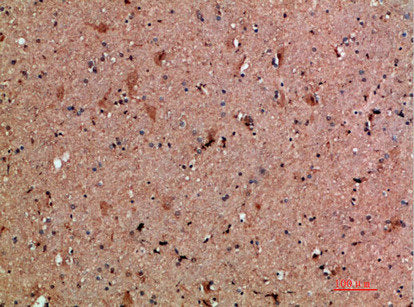 CLCF1 Antibody