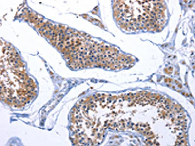 FABP3 Antibody
