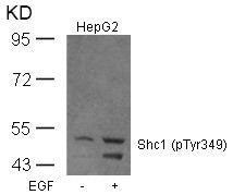 Phospho-SHC1 (Tyr349) Antibody