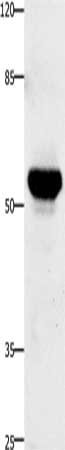 TNFRSF21 Antibody