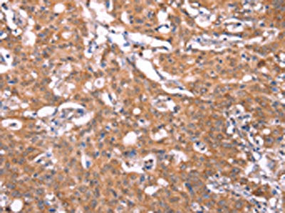 FBXO31 Antibody