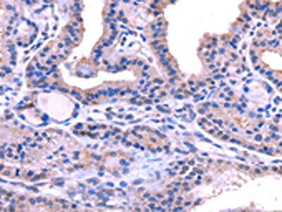 TRIM14 Antibody