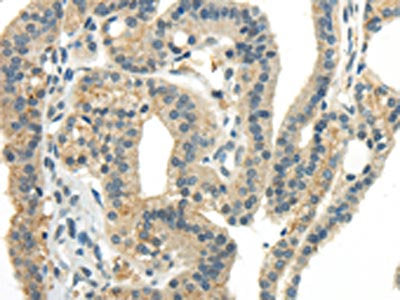 CCL13 Antibody
