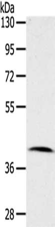 CDK10 Antibody