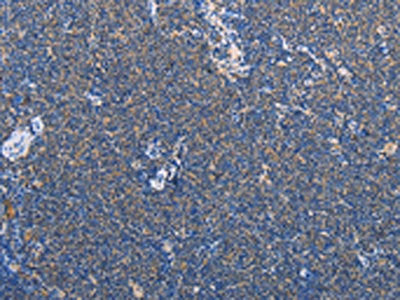 AMY2A Antibody