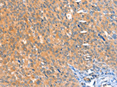 ACOX3 Antibody