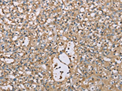 SCN1B Antibody