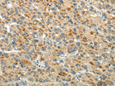 XK Antibody