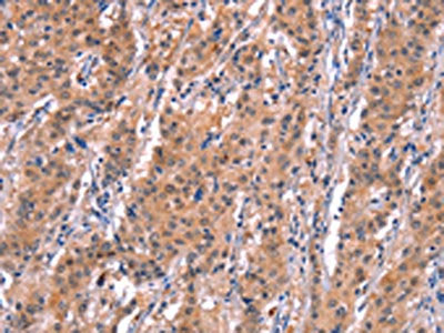 BCL6 Antibody