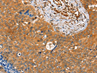 ACOT11 Antibody