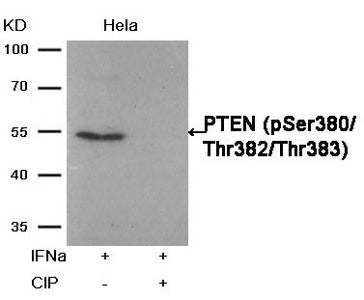Phospho-PTEN (Ser380/Thr382/Thr383) Antibody