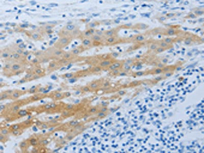 NPHS1 Antibody