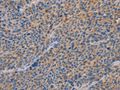 SPAG6 Antibody
