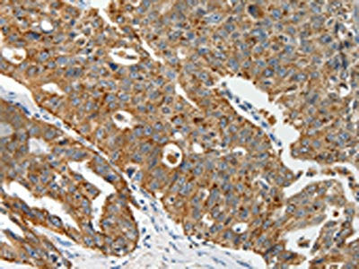 ABCD2 Antibody