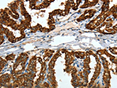 KRT19 Antibody