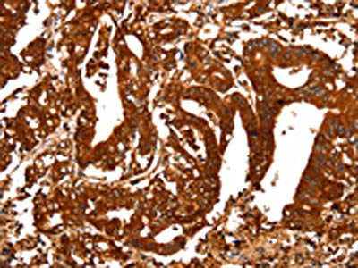 ALDOA Antibody