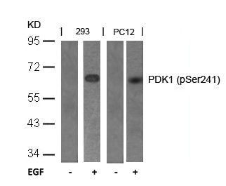 Phospho-PDPK1 (Ser241) Antibody