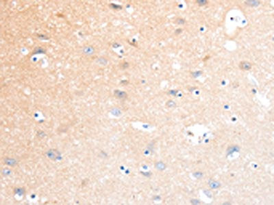SLC22A17 Antibody