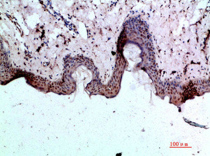 BMP1 Antibody