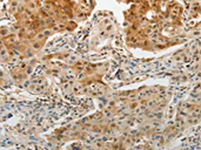 MGEA5 Antibody