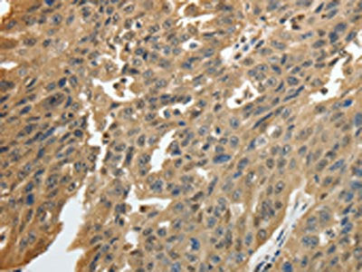 GSR Antibody