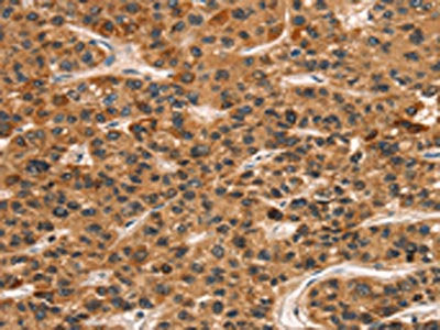 KLRC1 Antibody