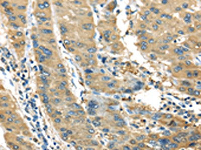 IL3RA Antibody