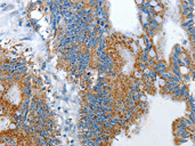 RARRES3 Antibody
