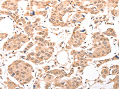 ACIN1 Antibody