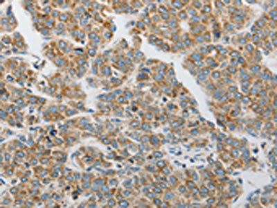 PRDX1 Antibody