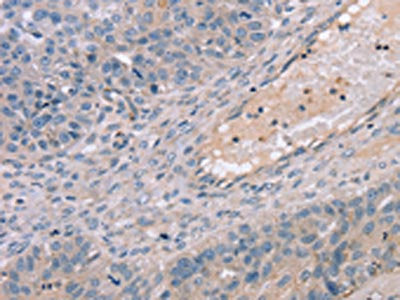 TERT Antibody