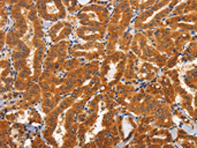 TNFRSF8 Antibody