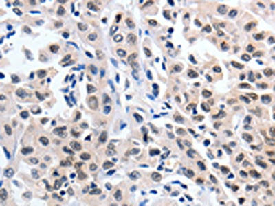 SUMO1 Antibody