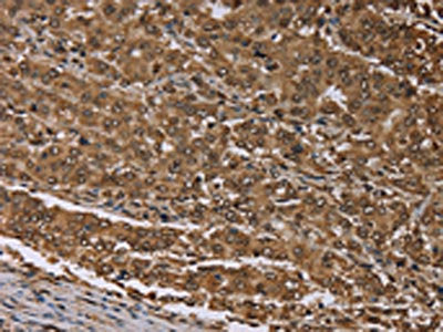 MEIS1 Antibody