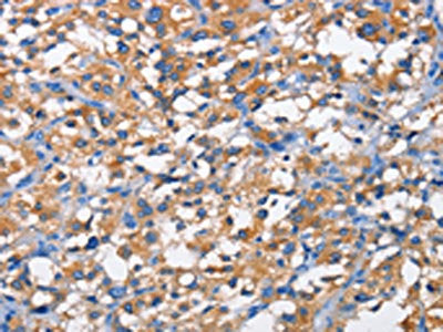 PFKP Antibody