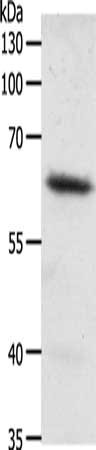 FZD4 Antibody