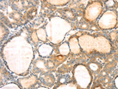 EVA1A Antibody