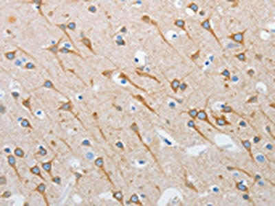 INTS1 Antibody