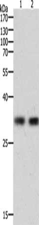 HAVCR1 Antibody
