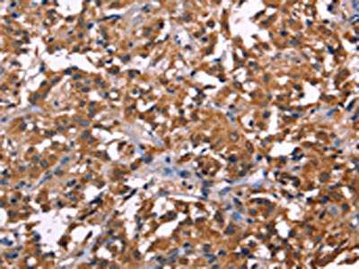 NOS2 Antibody