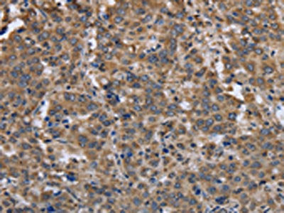 EPOR Antibody
